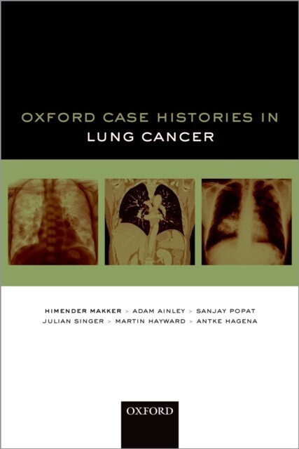 Oxford Case Histories in Lung Cancer main product photo