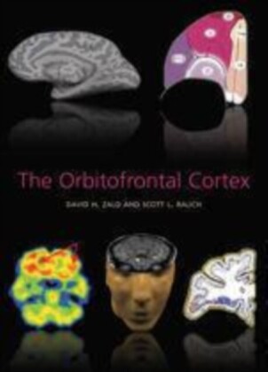 Orbitofrontal Cortex