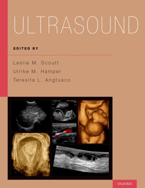 Ultrasound main product photo