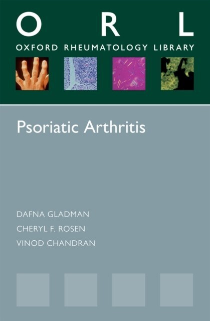Psoriatic Arthritis main product photo