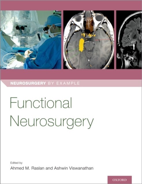 Functional Neurosurgery main product photo
