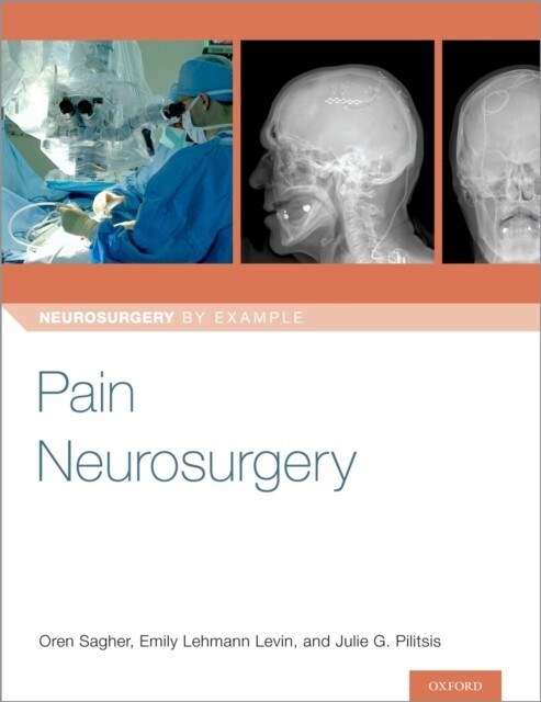 Pain Neurosurgery main product photo