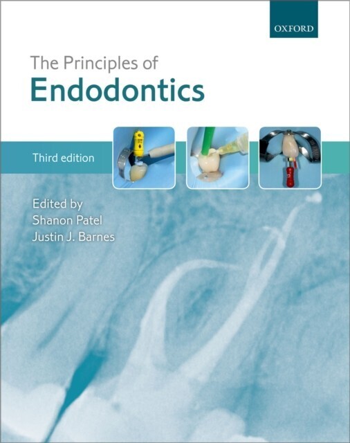 Principles of Endodontics main product photo