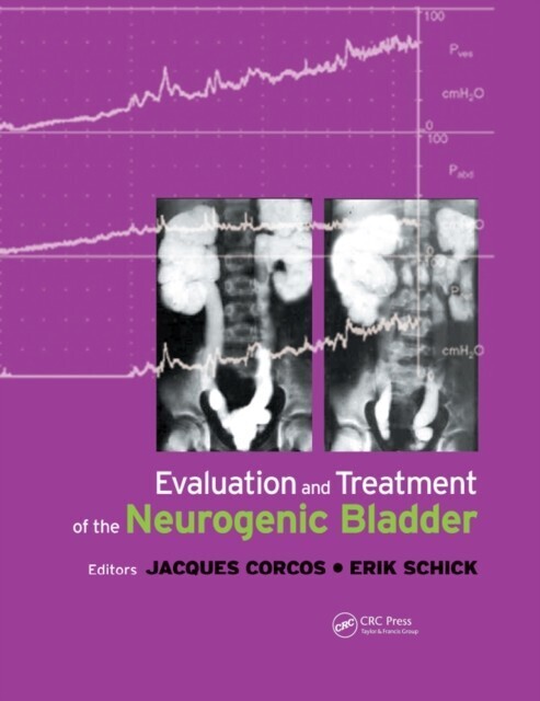 Evaluation and Treatment of the Neurogenic Bladder main product photo