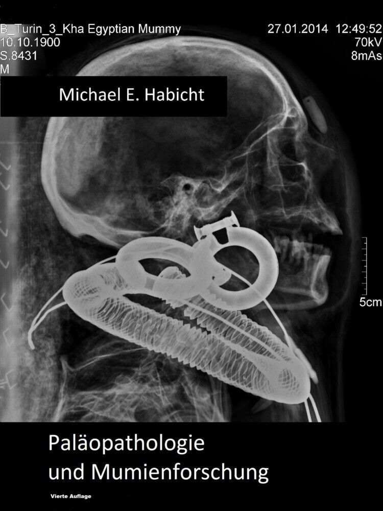 Handbuch Paleopathologie und Mumienforschung main product photo