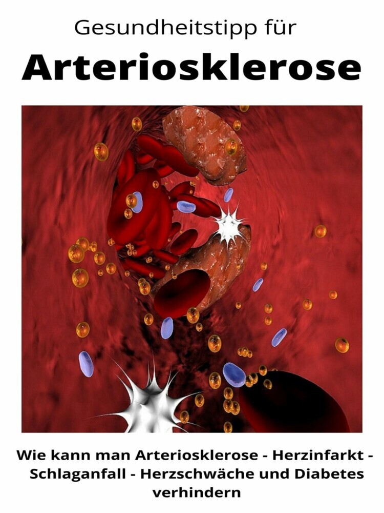 Gesundheitstipp für Arteriosklerose main product photo