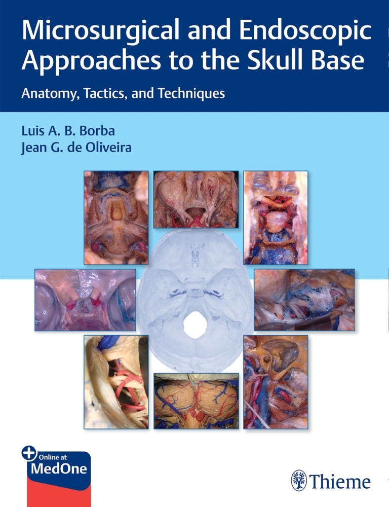 Microsurgical and Endoscopic Approaches to the Skull Base main product photo