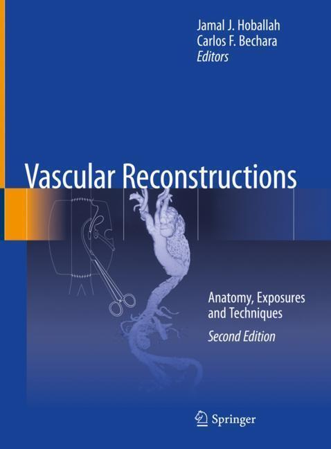 Vascular Reconstructions main product photo