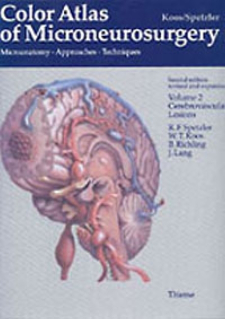 Color Atlas of Microneurosurgery: Volume 2 - Cerebrovascular Lesions main product photo