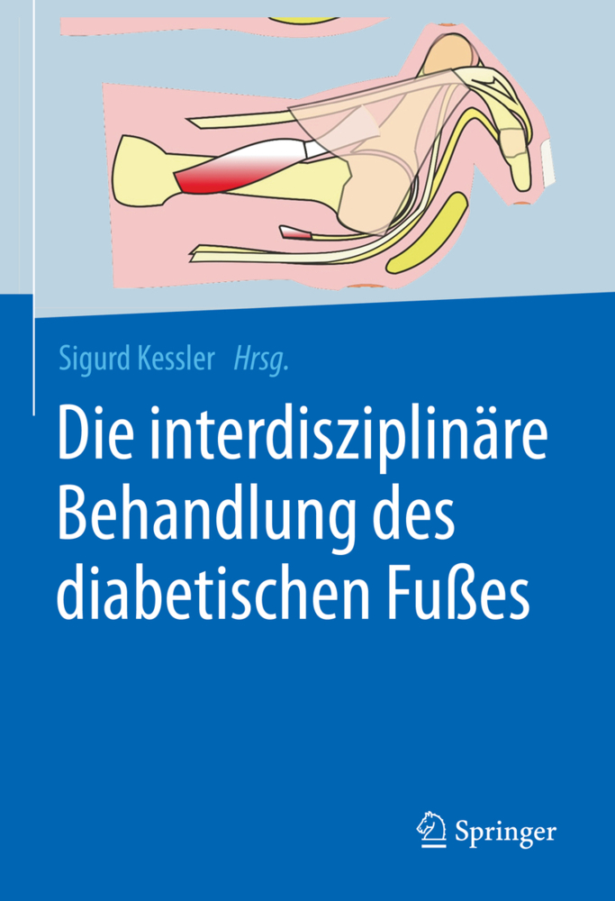 Die interdisziplinäre Behandlung des diabetischen Fußes main product photo