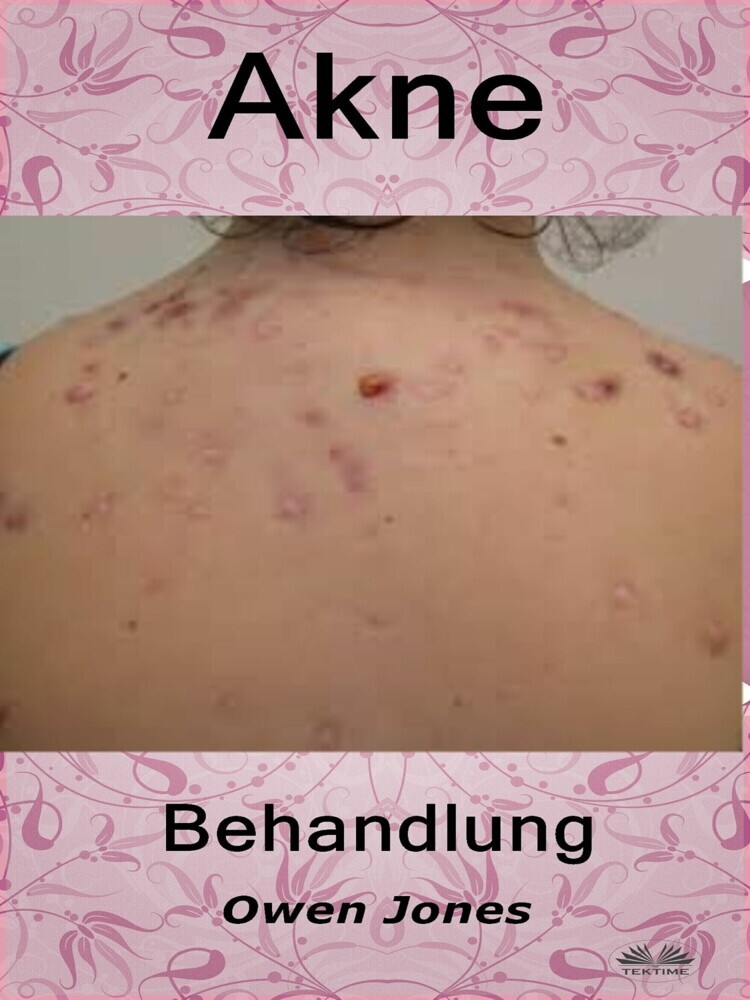 Akne-Behandlung main product photo