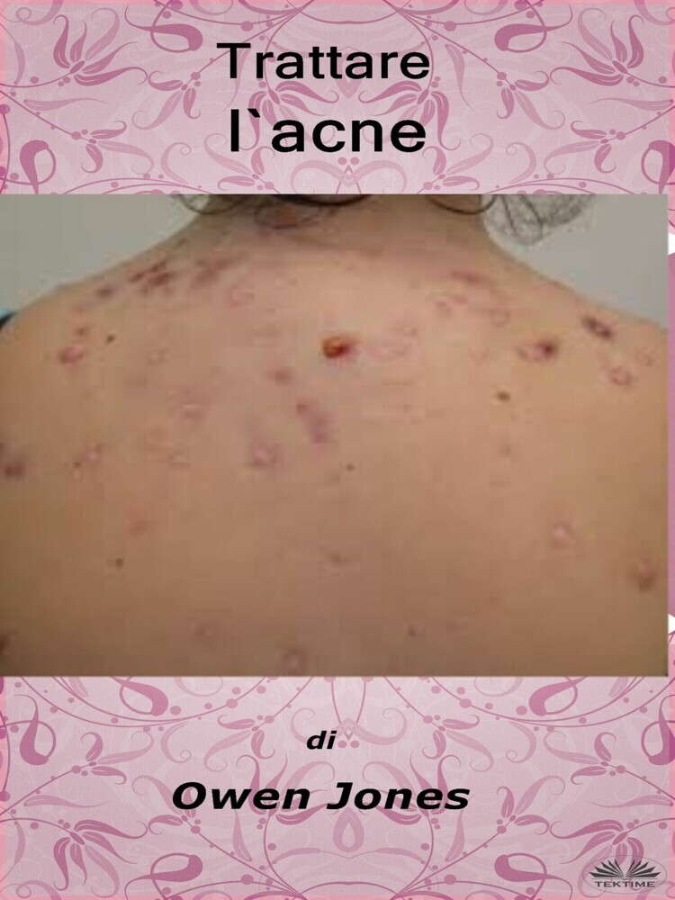 Trattare L'Acne main product photo