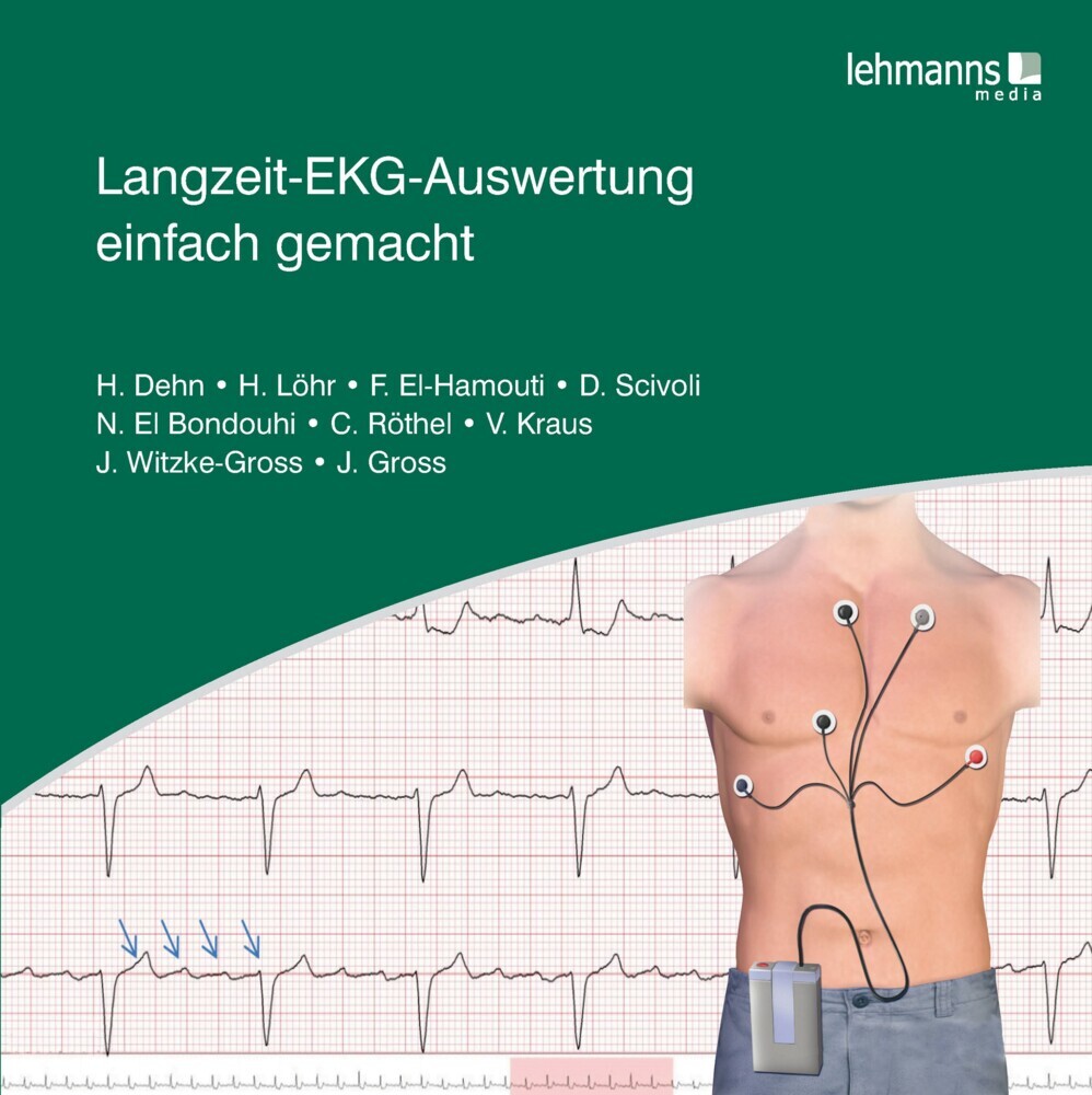 Langzeit-EKG-Auswertung einfach gemacht main product photo