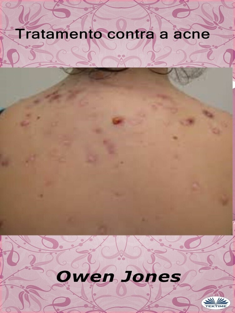 Tratamento Contra A Acne main product photo