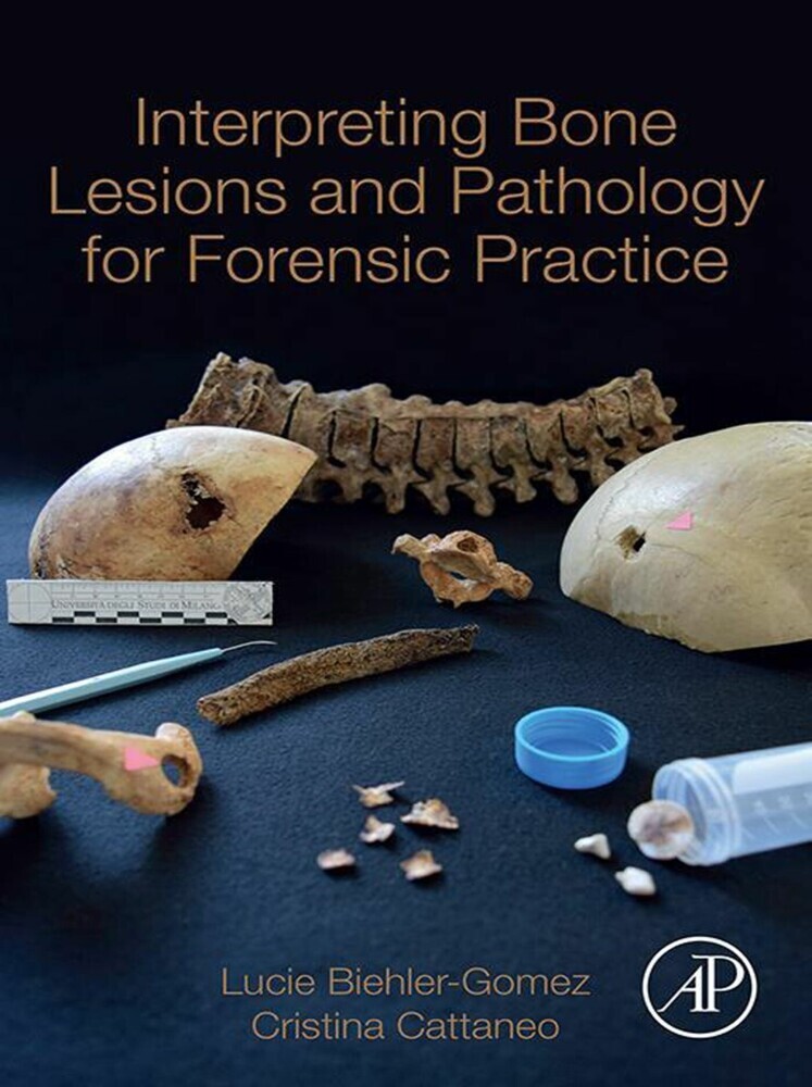 Interpreting Bone Lesions and Pathology for Forensic Practice main product photo
