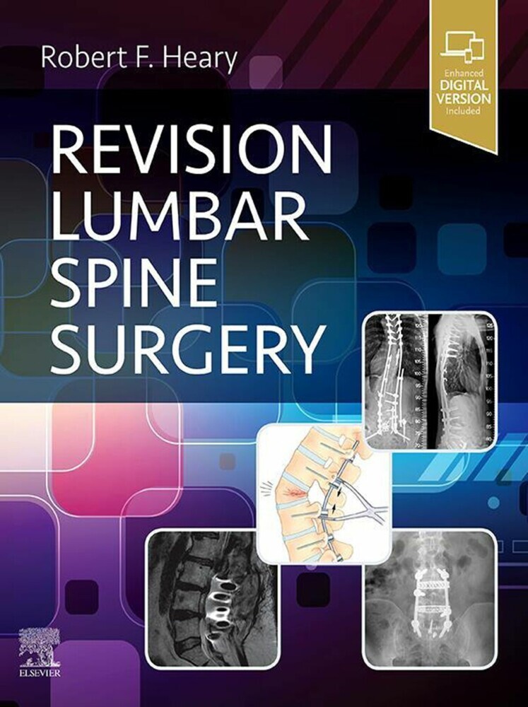 Revision Lumbar Spine Surgery E-Book main product photo
