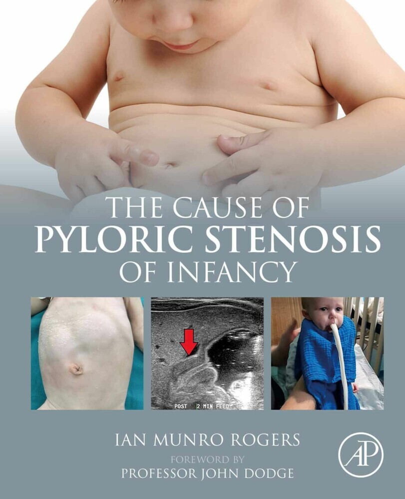 The Cause of Pyloric Stenosis of Infancy main product photo