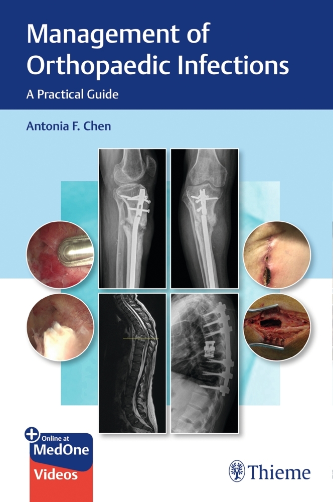 Management of Orthopaedic Infections main product photo