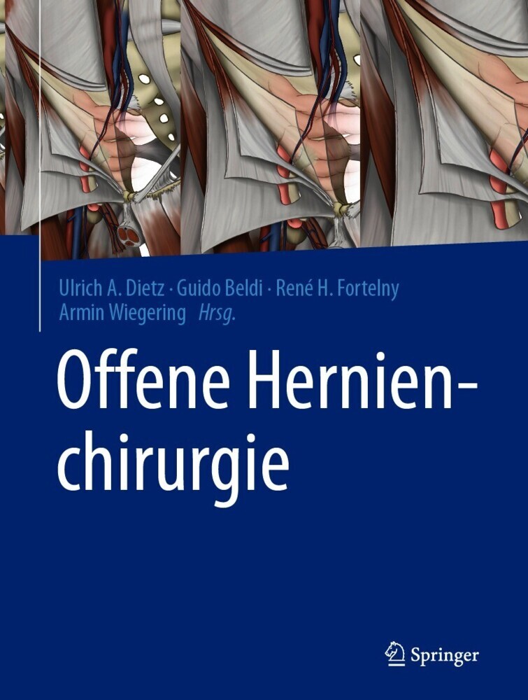 Offene Hernienchirurgie main product photo