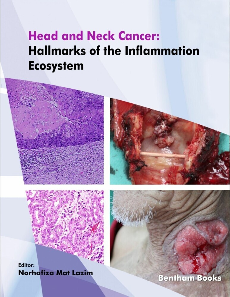 Head and Neck Cancer: Hallmarks of the Inflammation Ecosystem main product photo