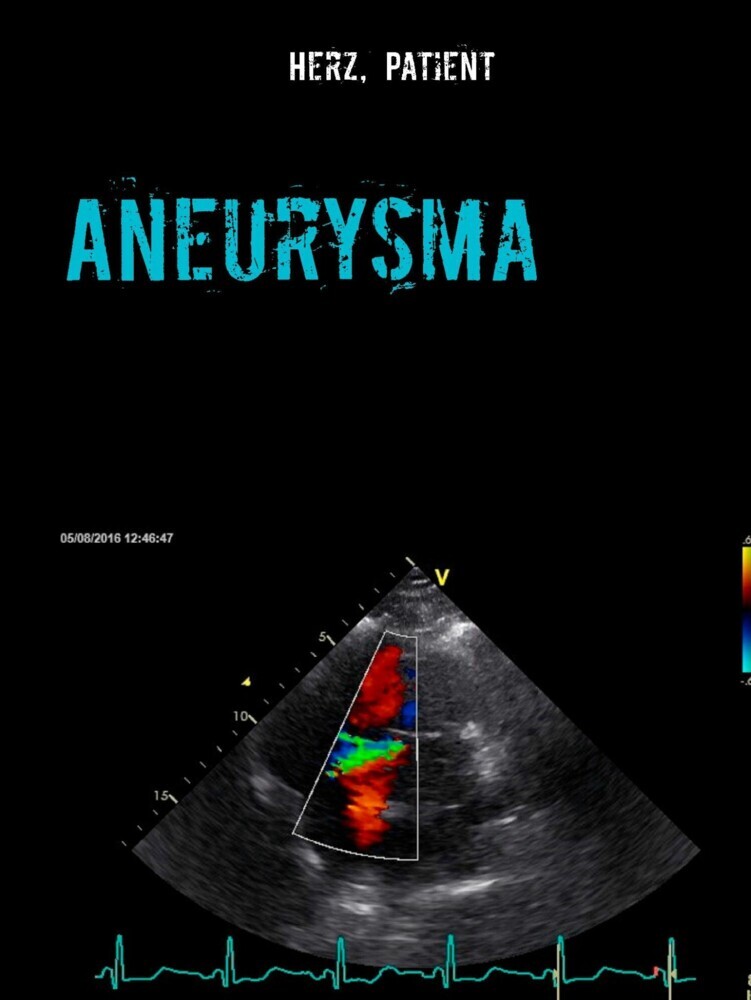 Aneurysma main product photo