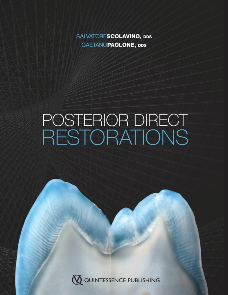 Posterior Direct Restorations main product photo