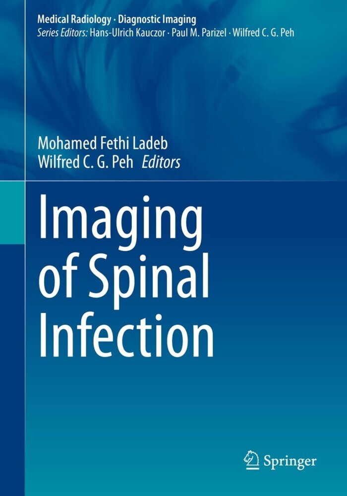 Imaging of Spinal Infection main product photo