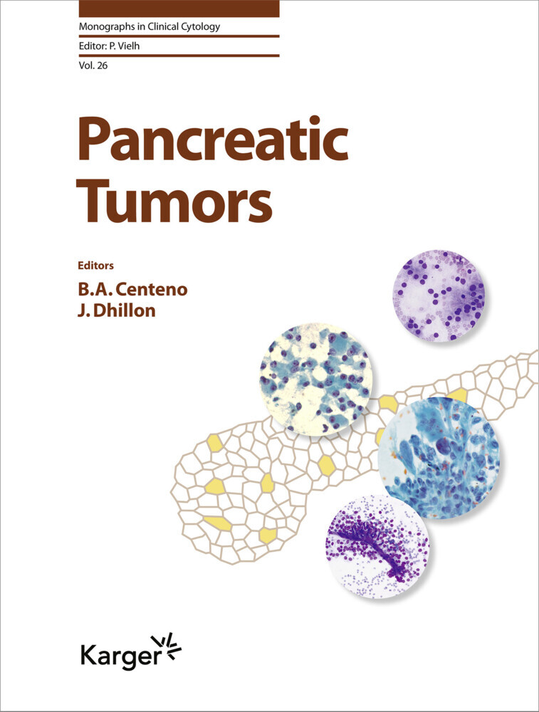 Pancreatic Tumors main product photo