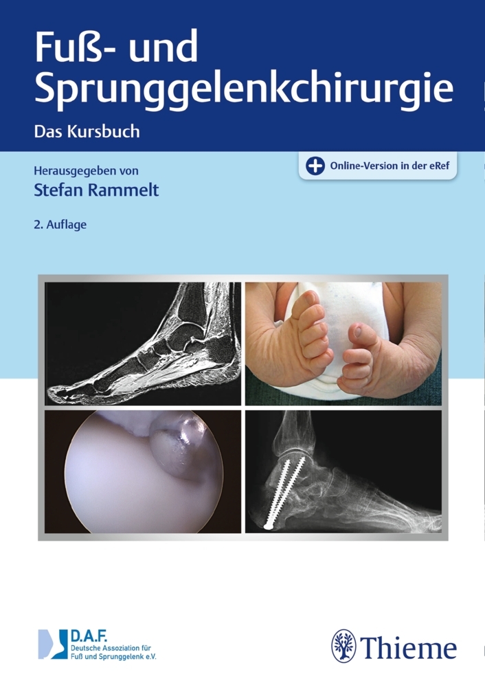 Fuß- und Sprunggelenkchirurgie main product photo