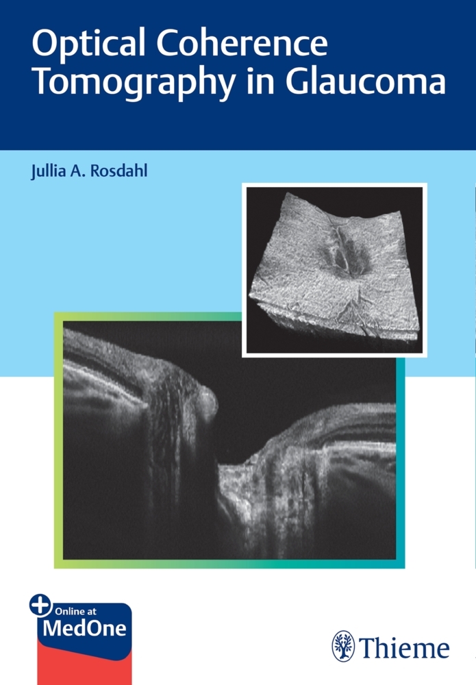 Optical Coherence Tomography in Glaucoma main product photo