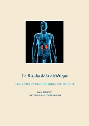 Le b.a-ba de la diététique pour les coliques néphrétiques xanthiques