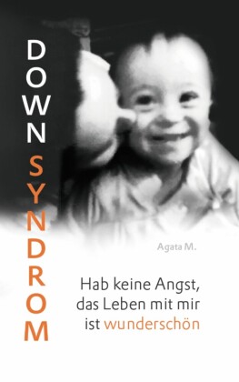 Down Syndrom