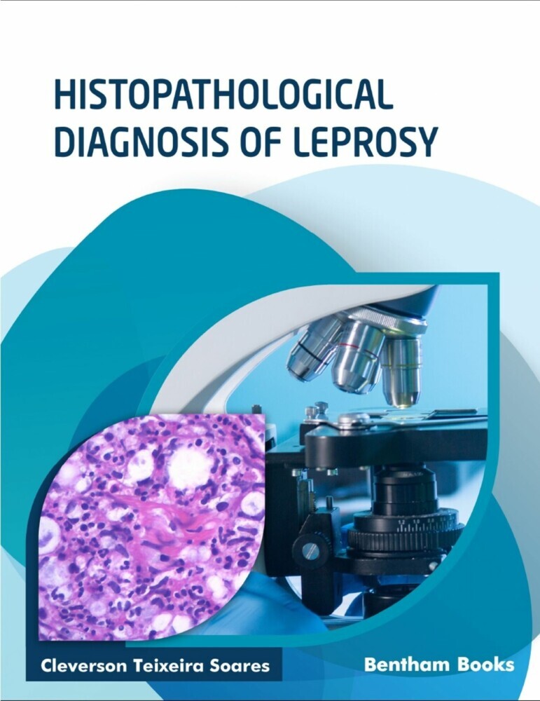 Histopathological Diagnosis of Leprosy main product photo
