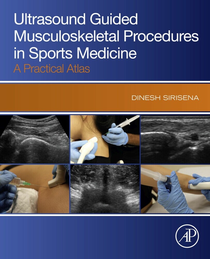 Ultrasound Guided Musculoskeletal Procedures in Sports Medicine main product photo