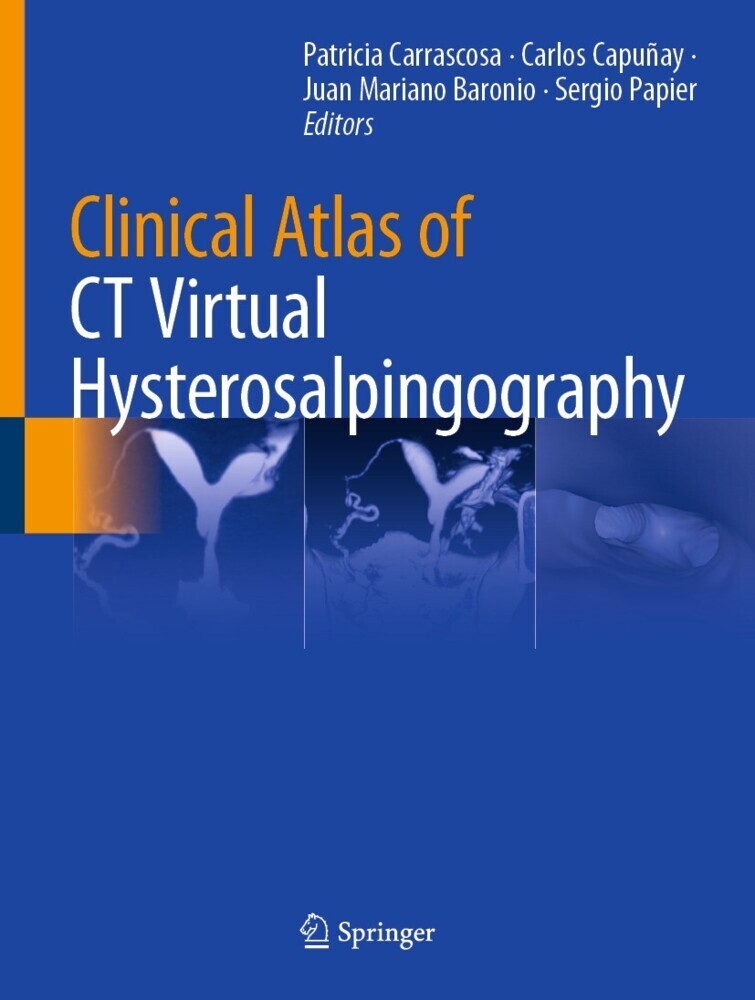 Clinical Atlas of CT Virtual Hysterosalpingography main product photo