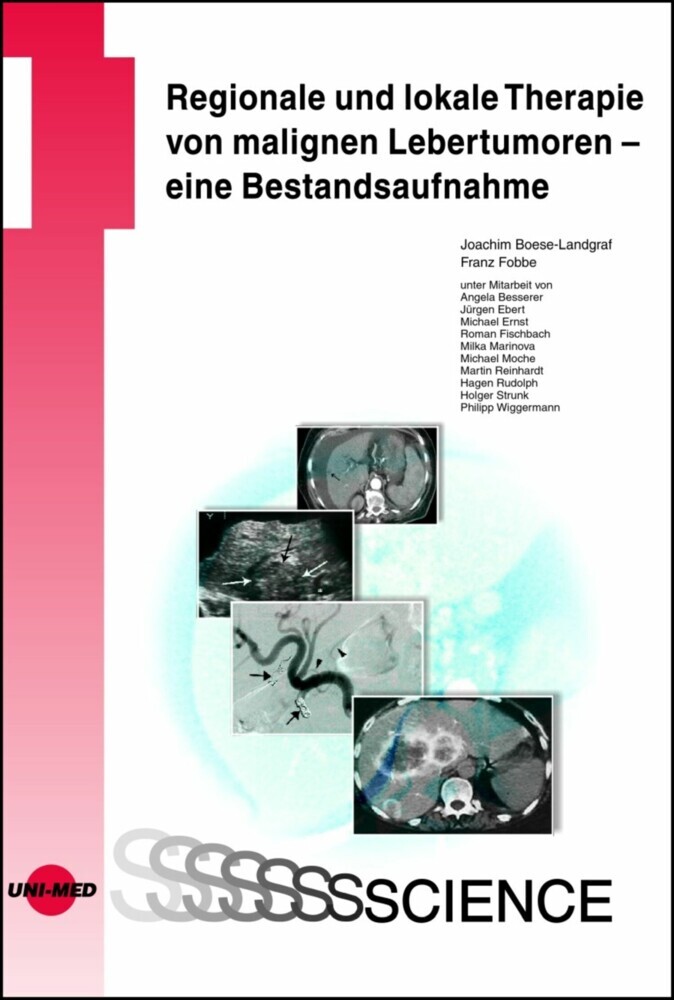 Regionale und lokale Therapie von malignen Lebertumoren - eine Bestandsaufnahme main product photo
