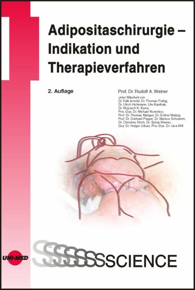 Adipositaschirurgie - Indikation und Therapieverfahren main product photo