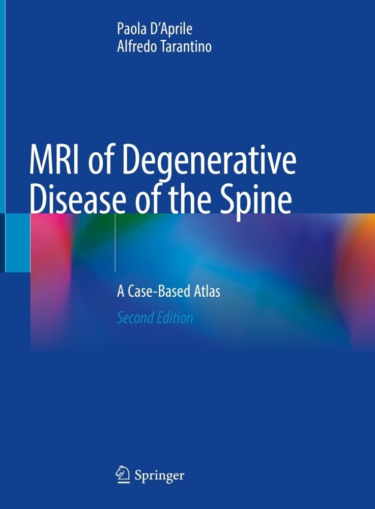 MRI of Degenerative Disease of the Spine main product photo