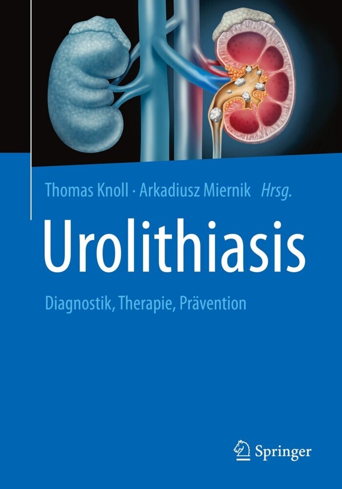 Urolithiasis main product photo