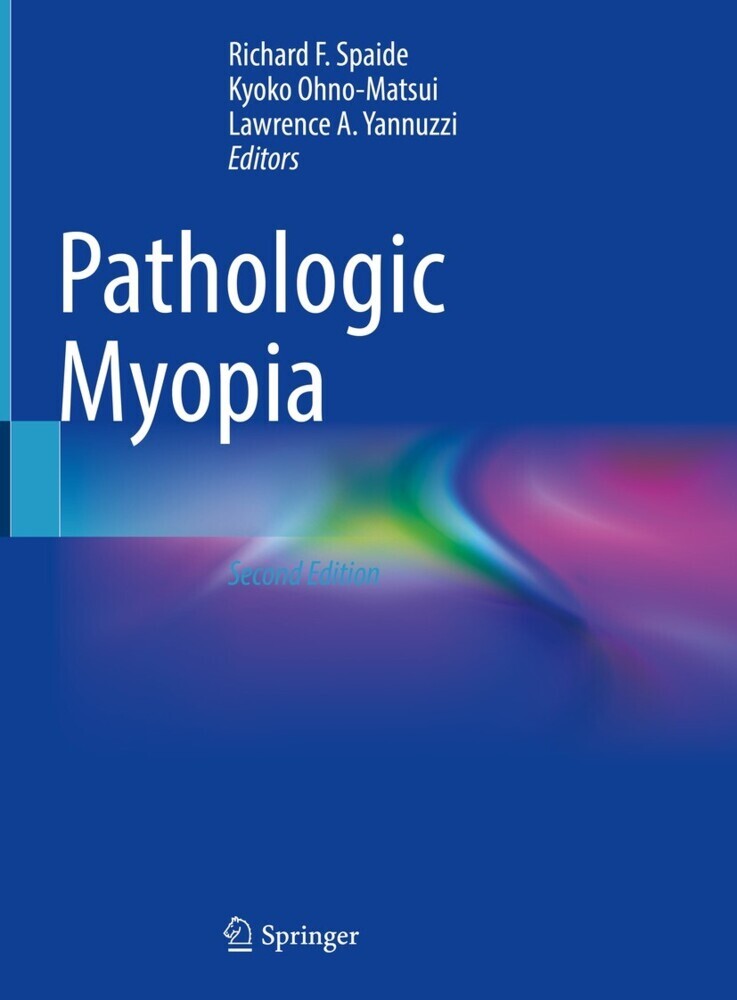 Pathologic Myopia main product photo