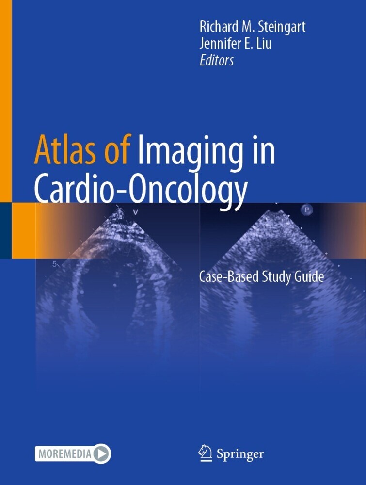 Atlas of Imaging in Cardio-Oncology main product photo