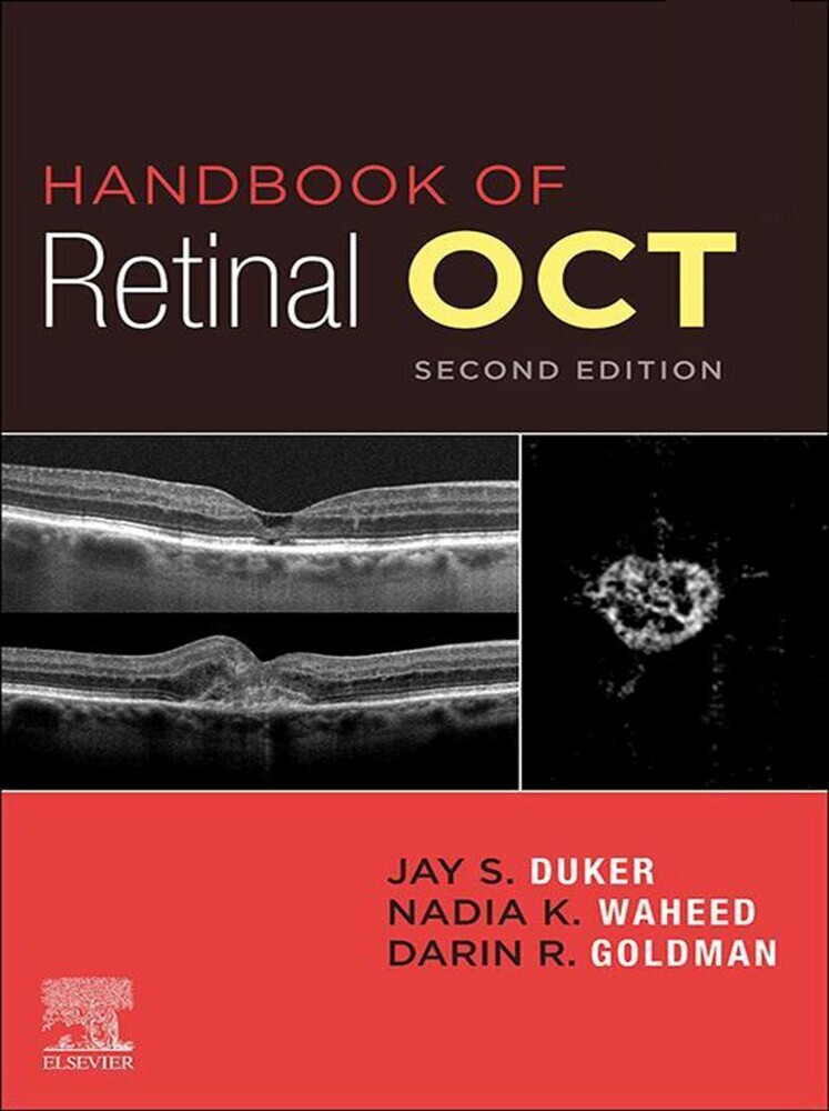 Handbook of Retinal OCT: Optical Coherence Tomography E-Book main product photo