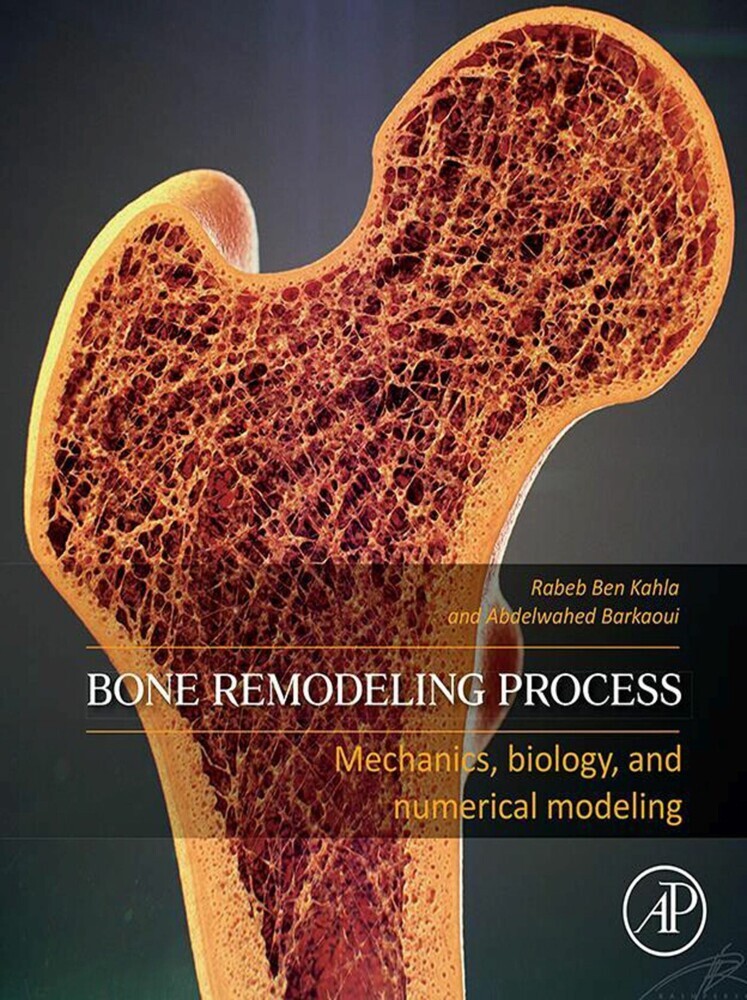 Bone Remodeling Process main product photo