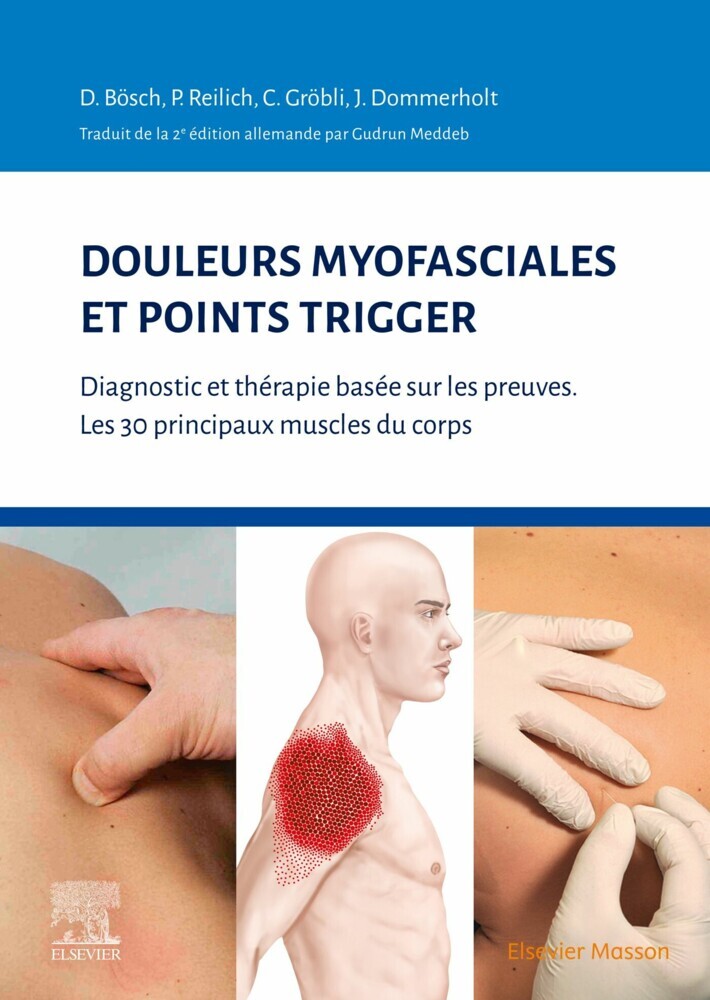 Douleurs myofasciales et points trigger main product photo