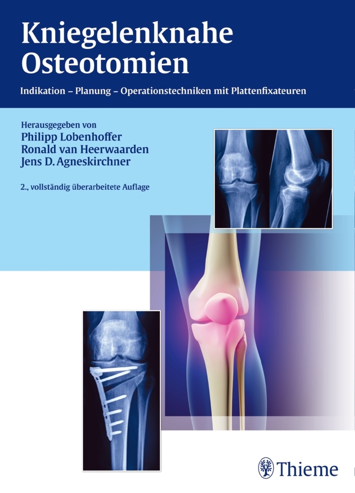 Kniegelenknahe Osteotomien main product photo