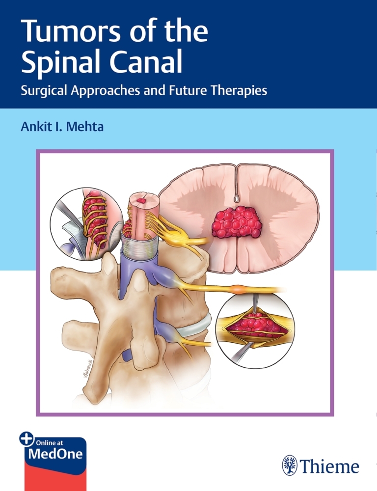 Tumors of the Spinal Canal main product photo