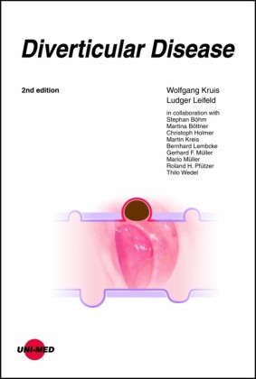 Diverticular Disease
