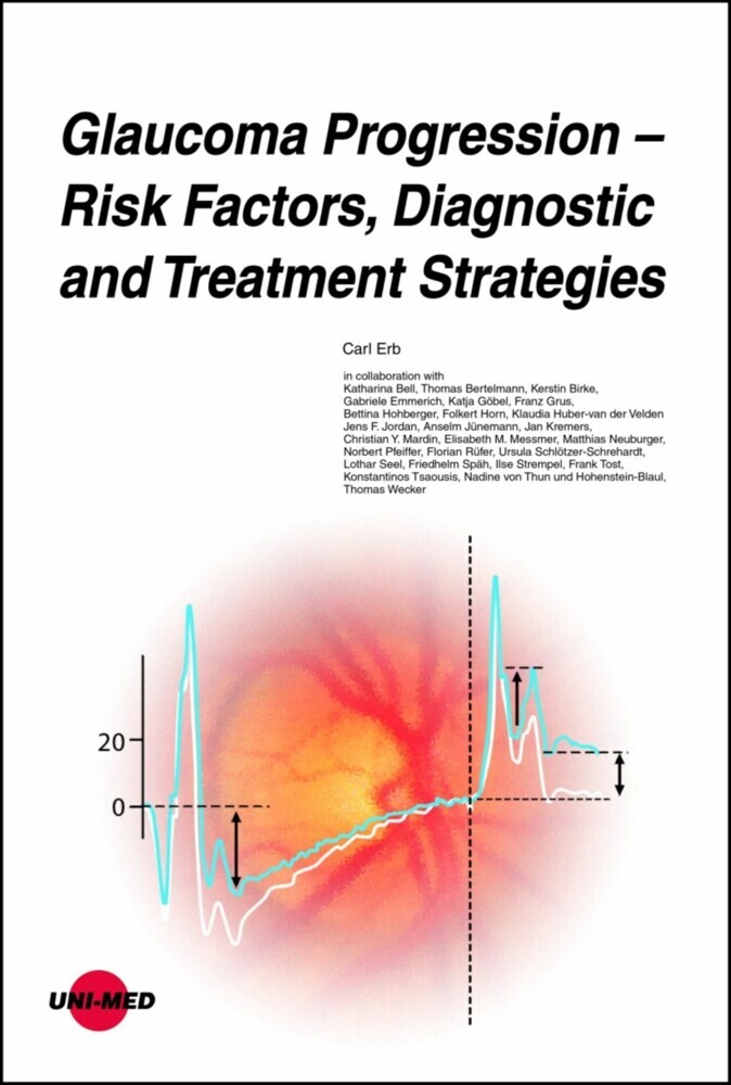 Glaucoma Progression - Risk Factors, Diagnostic and Treatment Strategies main product photo