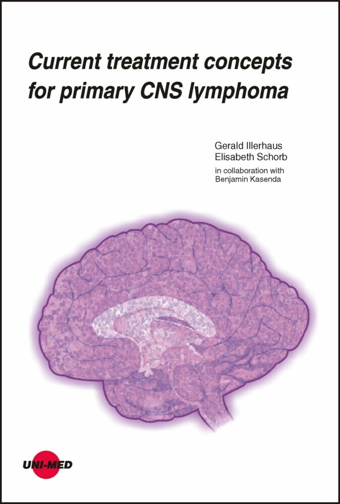 Current treatment concepts for primary CNS lymphoma main product photo