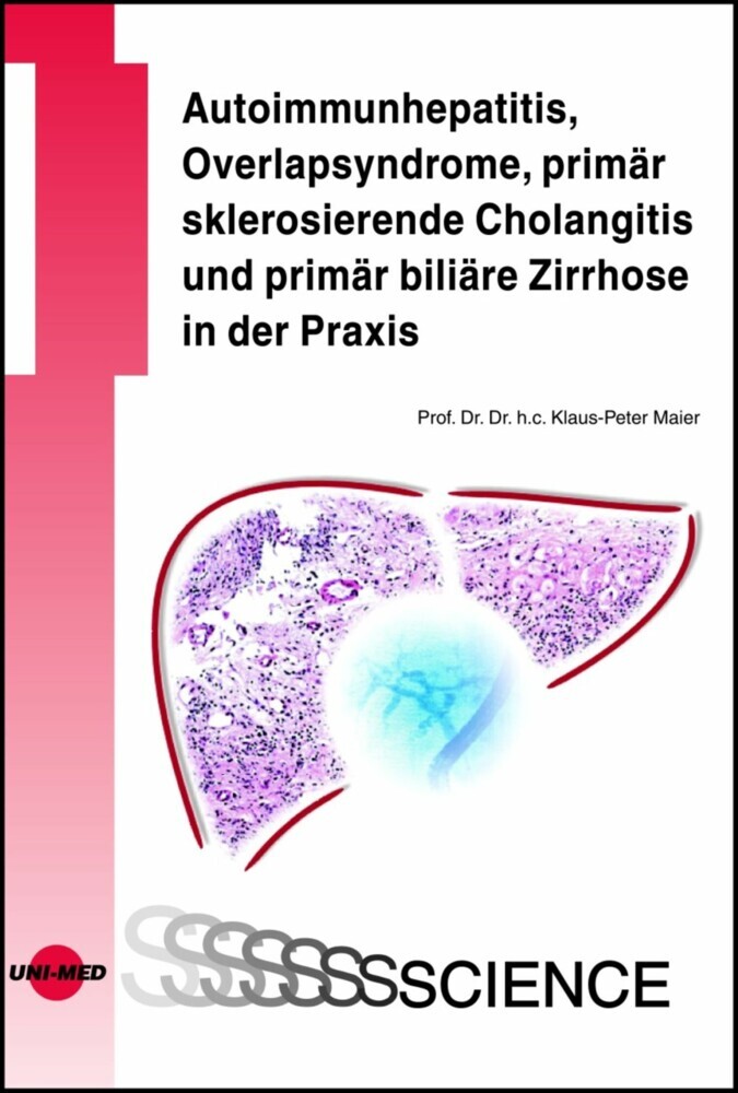 Autoimmunhepatitis, Overlapsyndrome, primär sklerosierende Cholangitis und primär biliäre Zirrhose in der Praxis main product photo